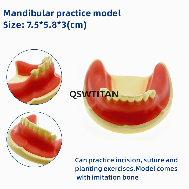 Teeth Model Implant Practice For incision drilling Practices Dental Study Model
