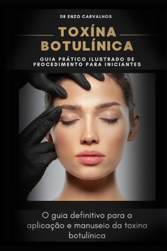 Enzo Carvalhos Toxína Botulínica (Paperback)