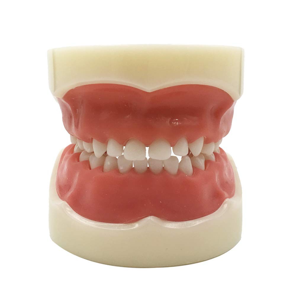 Typodont Child Teeth Model with 24pcs Removable Teeth Compatible with Kilgore...