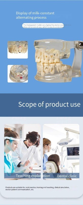 Dental Teeth Model Demo 3-12 Child Permanent Tooth Alternate Developement Proces
