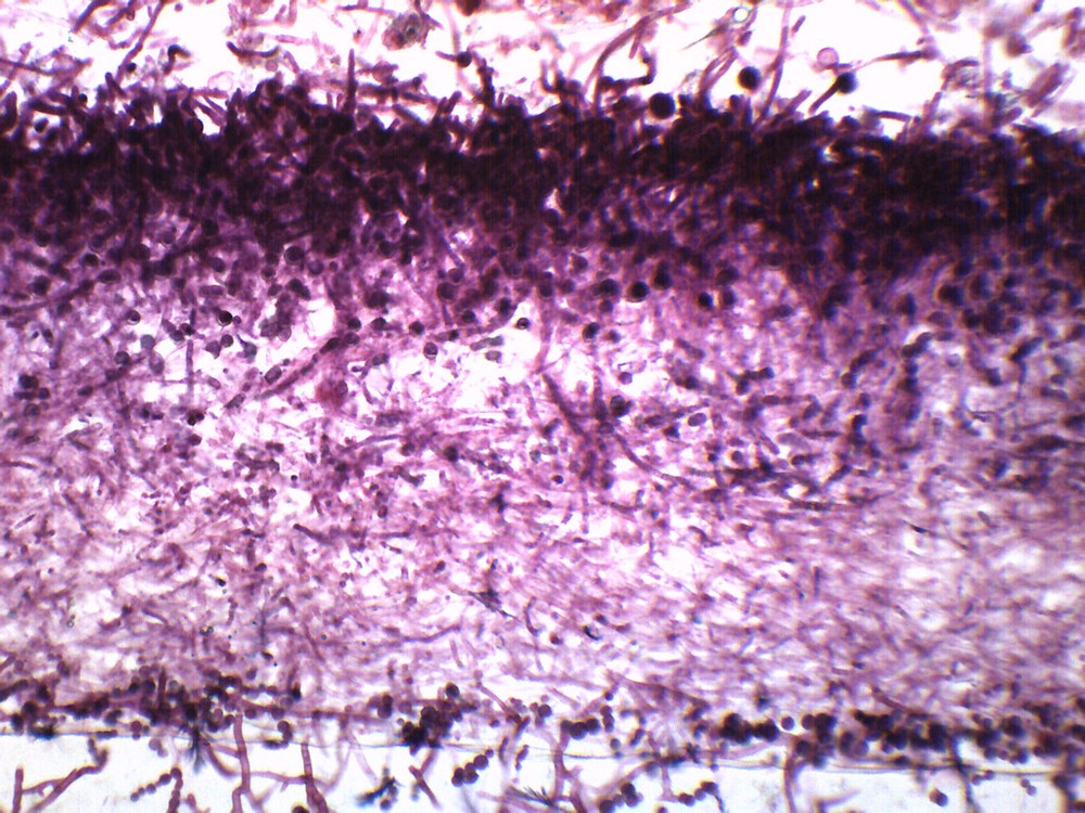 Mucor - Prepared Microscope Slide - 75x25mm - Eisco Labs