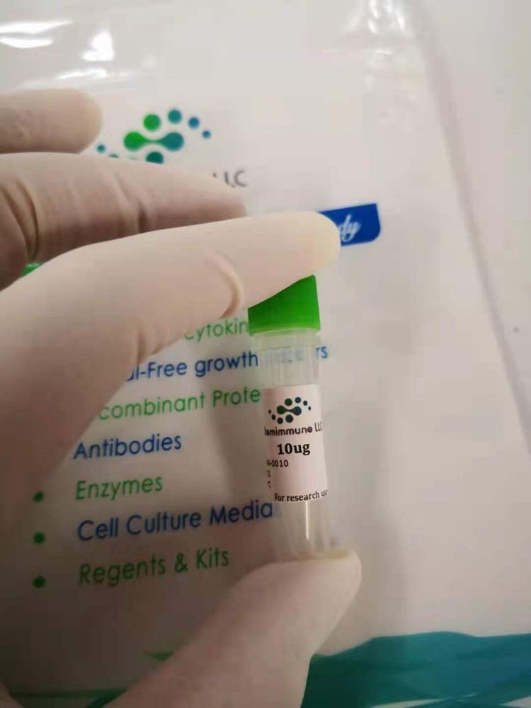 Recombinant Human TNFa Protein 10ug expressed in human cells
