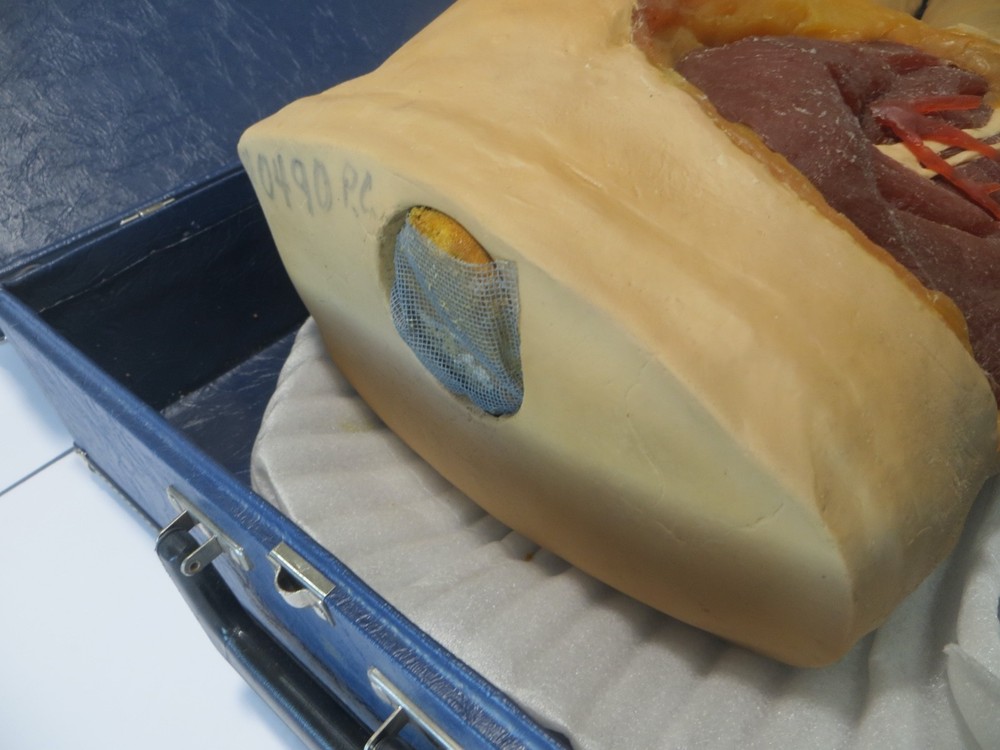 Nasco Life Form LF961 Intramuscular Injection Simulator