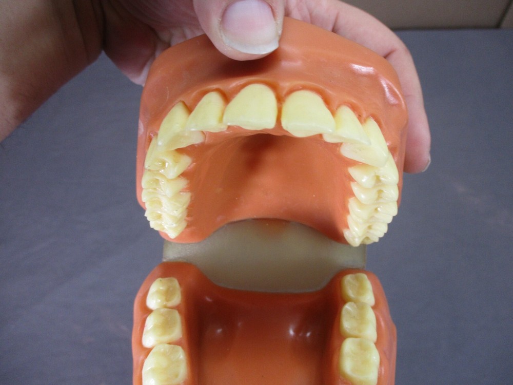 Dentist Typodont Dentoform Dental Model Teeth Overbite Tooth Display Hinged Set