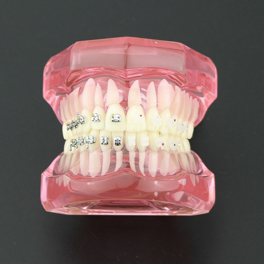 Dental Orthodontic Teeth Model Self-ligating ChainMetal Ceramic Bracket