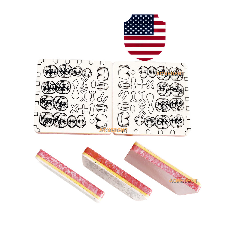 Dental Cavity Tooth Preparation Blocks Caries Remove Model Student Trainer only1