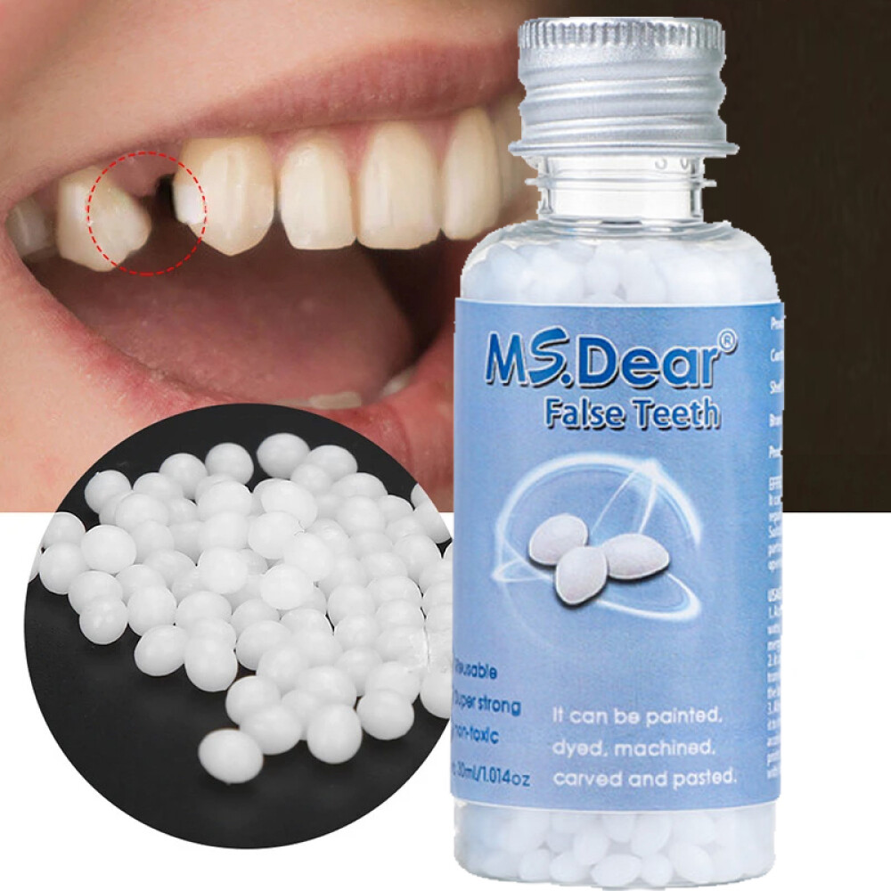 Tooth Repair Kit - Temporary Teeth Replacement Kit for Missing & Broken Teeth