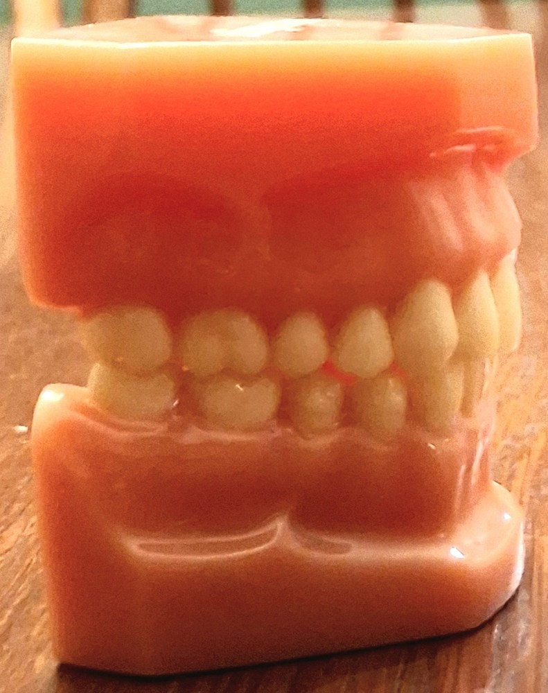 Invisalign Typodont