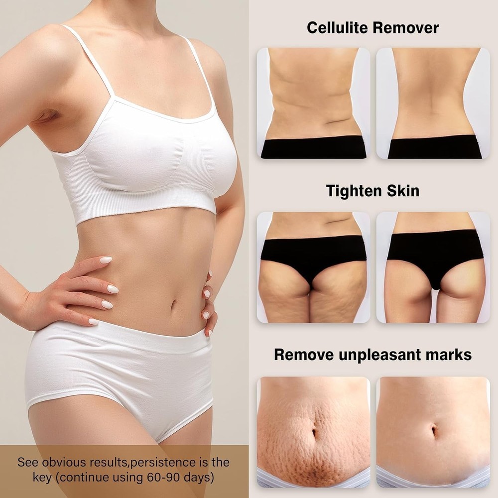 Body Sculpting Machine, Cellulite Massager Tool, Cordless Handheld White