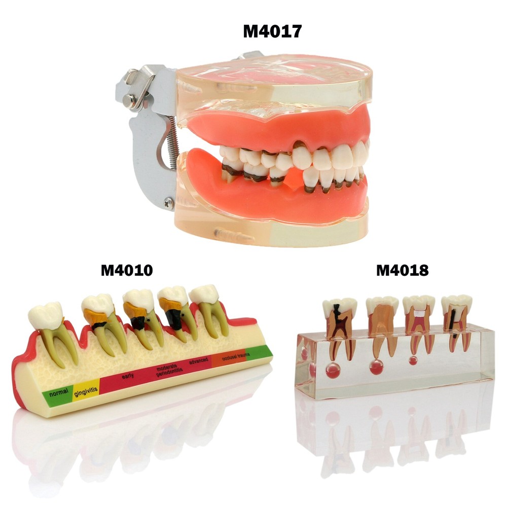 Dental Caries Periodontal Disease Dentoform Typodont Study Teaching Teeth Model