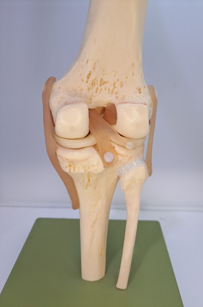 Vintage 1995 Somso Anatomical Model Functional Knee Joint Model BIN86