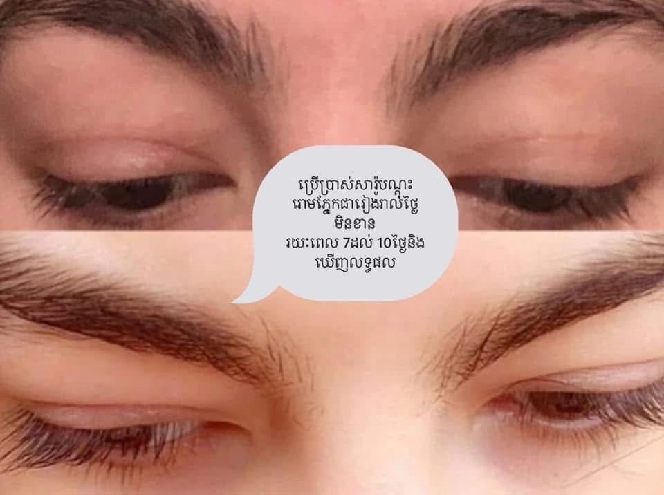 SK Long Lashes Serum សេរ៉ូមបណ្តុះរោមភ្នែក រោមចិញ្ចើម អោយវែង ( 1B / 5ml )