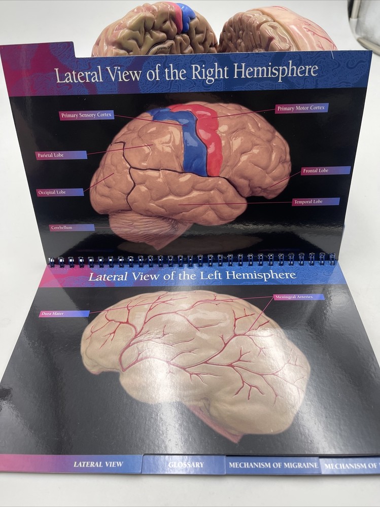 Maxalt Brain Anatomical Model Migraine Pathology Education Teaching Model
