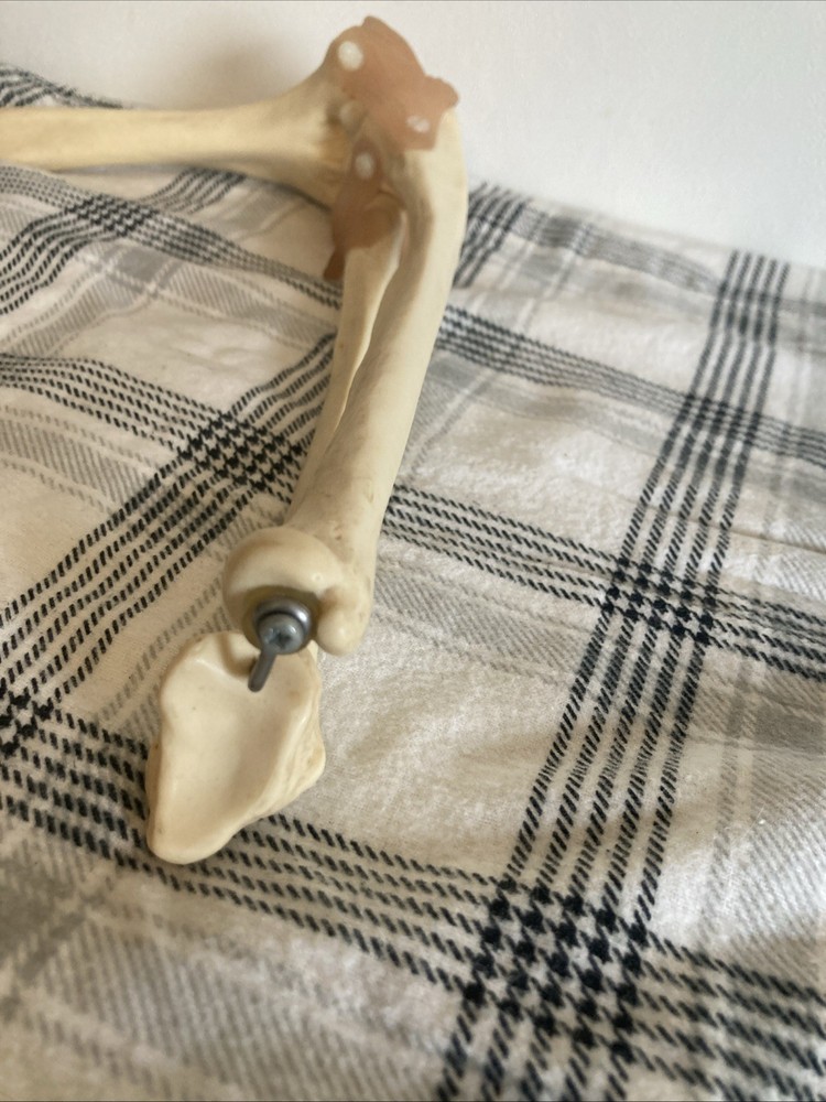 Somso Anatomical Elbow Joint Model. Read