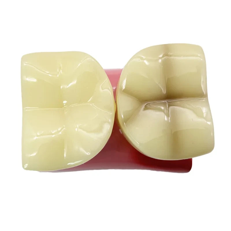 Dental Caries Disease Model Periodontitis Case Analysis Study Demo Teeth Model