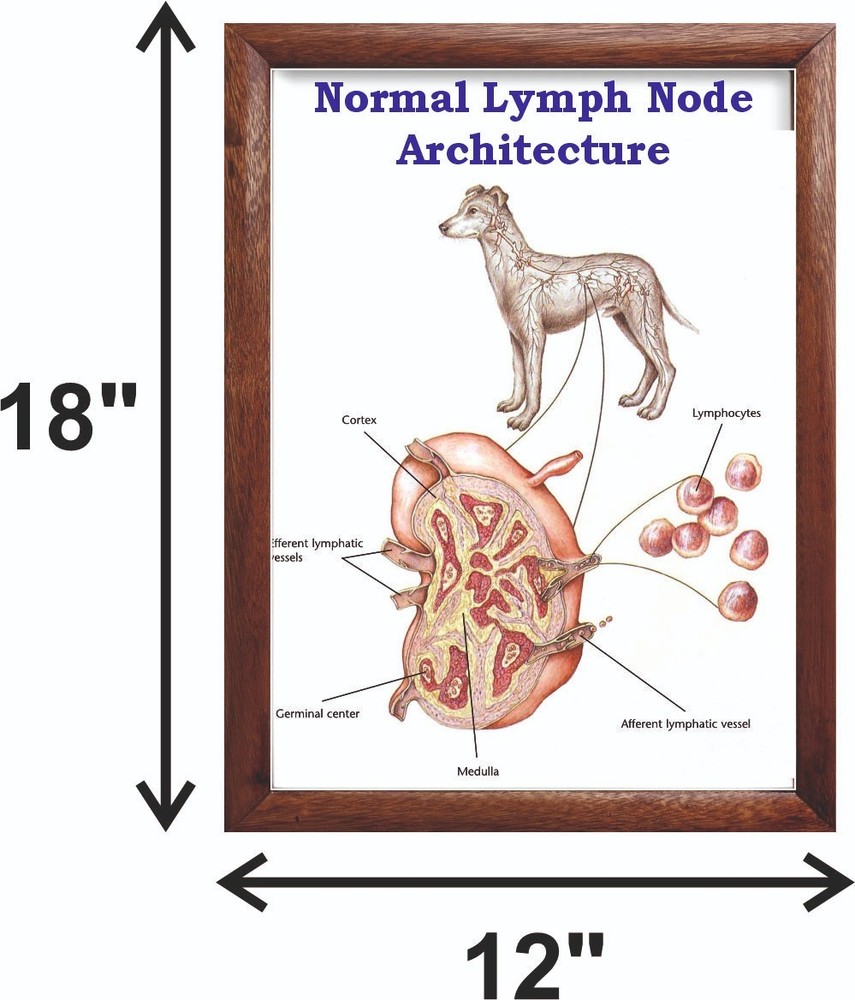 Normal Lymph Node Architecture Chart 12x18 inches