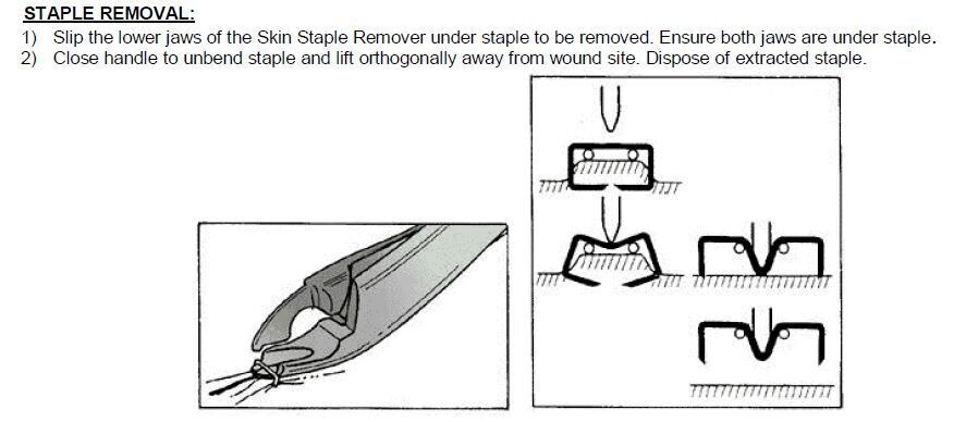Skin Staple Remover with Scissor Handle