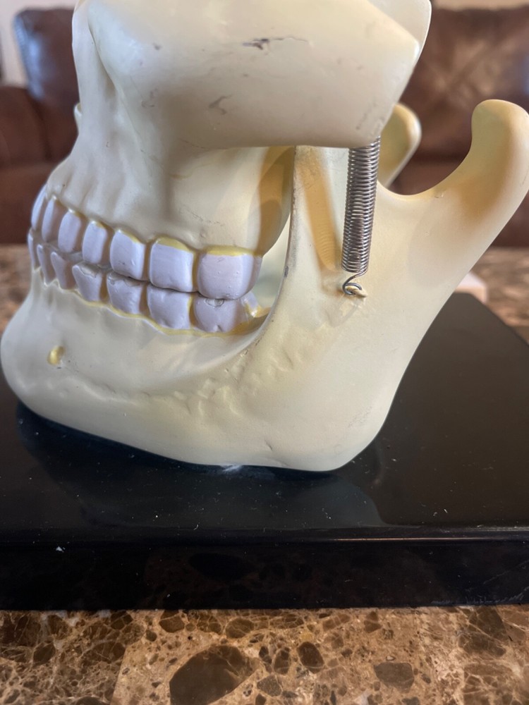 Deluxe Upper & Lower Jaw Model