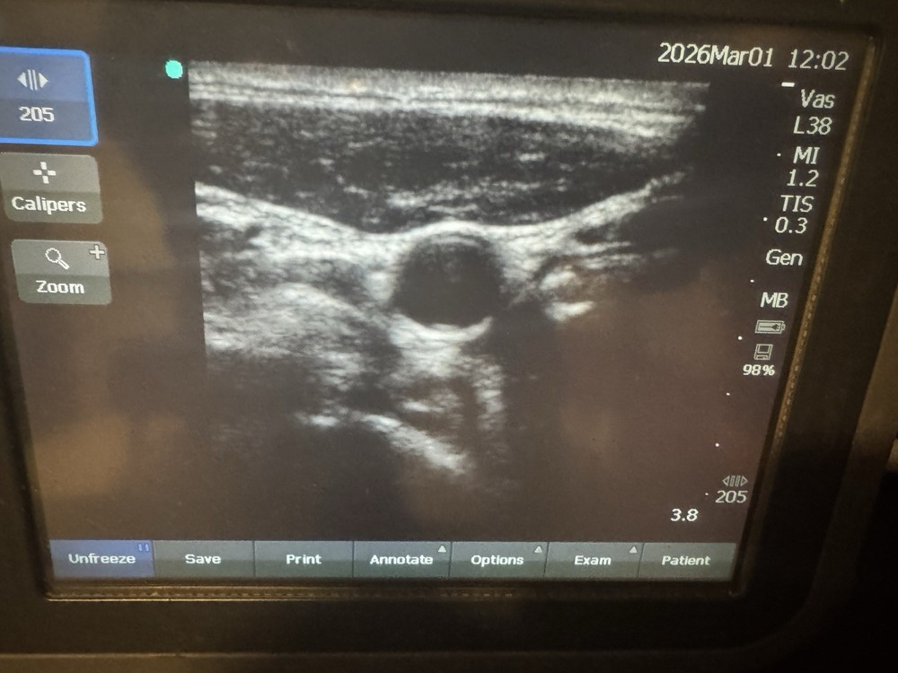 SonoSite L38n/10-5 MHz Linear Array Transducer Probe