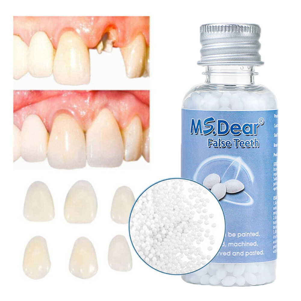 Tooth Repair Kit - Temporary Teeth Replacement Kit for Missing & Broken Teeth US