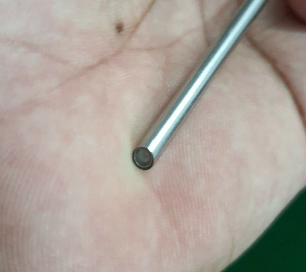 Laparoscopic Endoscope 4mm 30 Degree Laparoscope Endoscopy Reusable Instruments