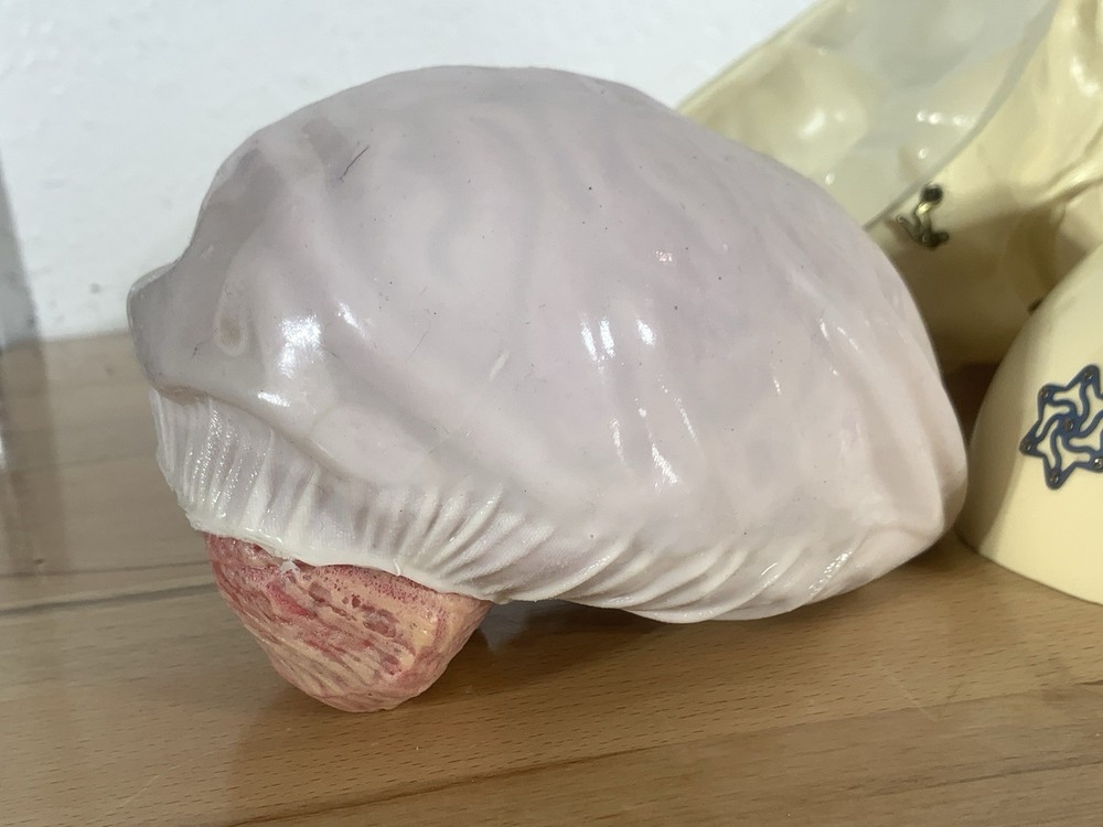 Anatomically Correct Life Size Skull Removable Cranium & Brain Teaching Aid