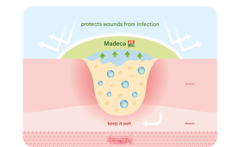Madecassol Hydrocolloid Dressing / Bandage