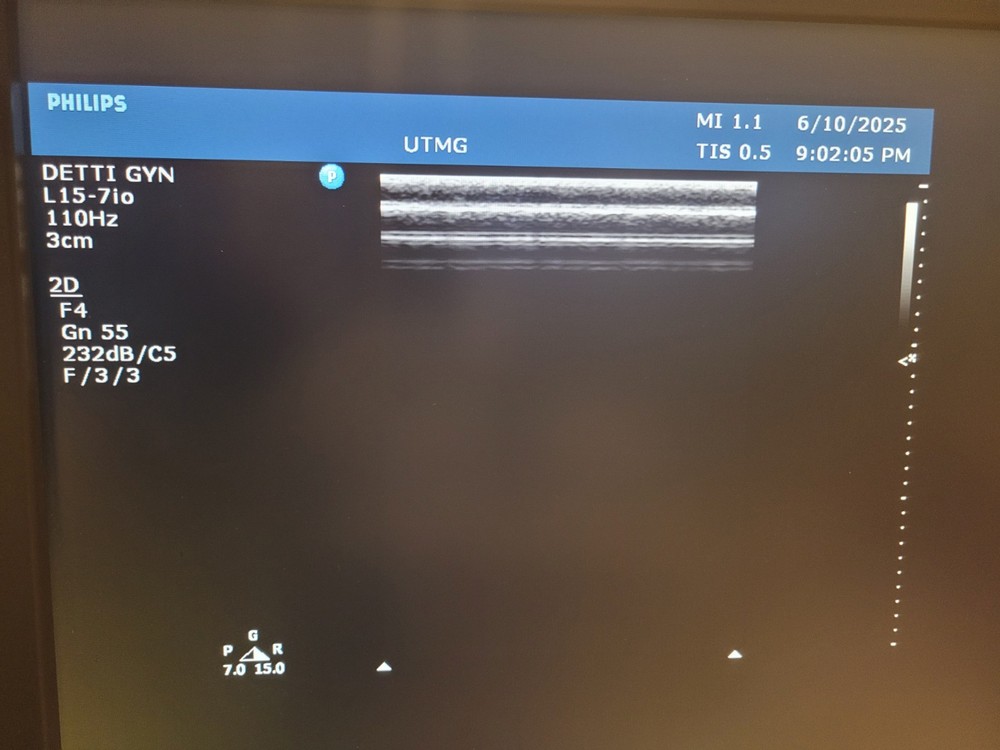 PHILIPS L15-7IO LINEAR ARRAY ULTRASOUND TRANSDUCER PROBE EXCELLENT CONDITION