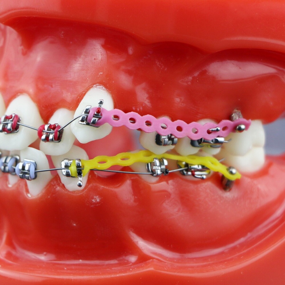 Dental Teeth Teaching Model Orthodontic Model Metal Arch Ceramic Brackets