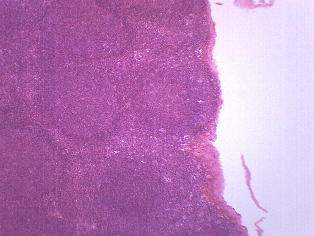 Lymph Node Section - Prepared Microscope Slide - 75x25mm - Eisco Labs
