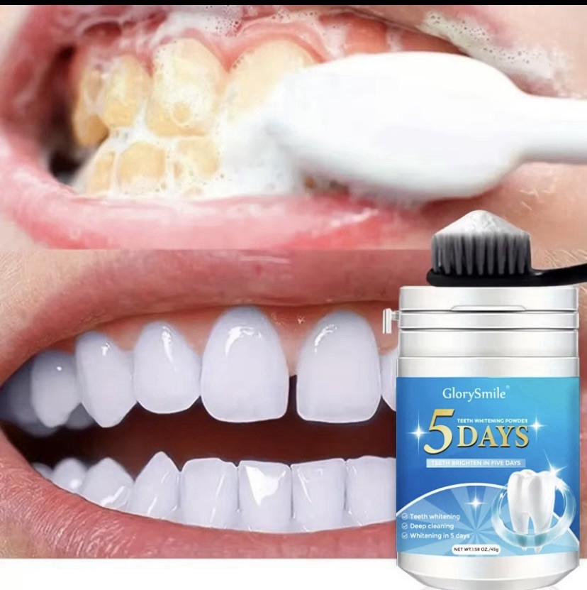 teeth whitened in 5 days