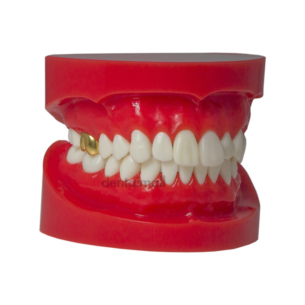 Dental Teeth Crown Restoration Model with Post Core Bridge for Teaching M6004