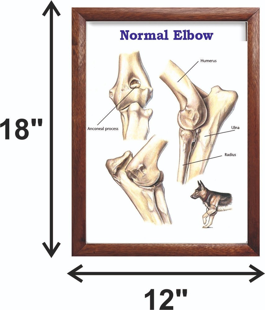 Normal Elbow Chart 12x18 inches