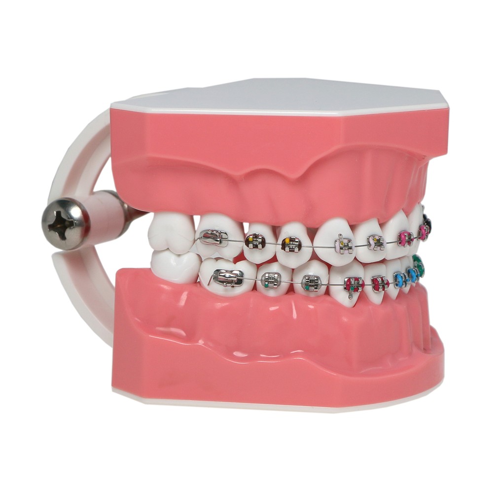 US Dental Typodont Demonstration Teeth Model with Braces For Patient Teach Study