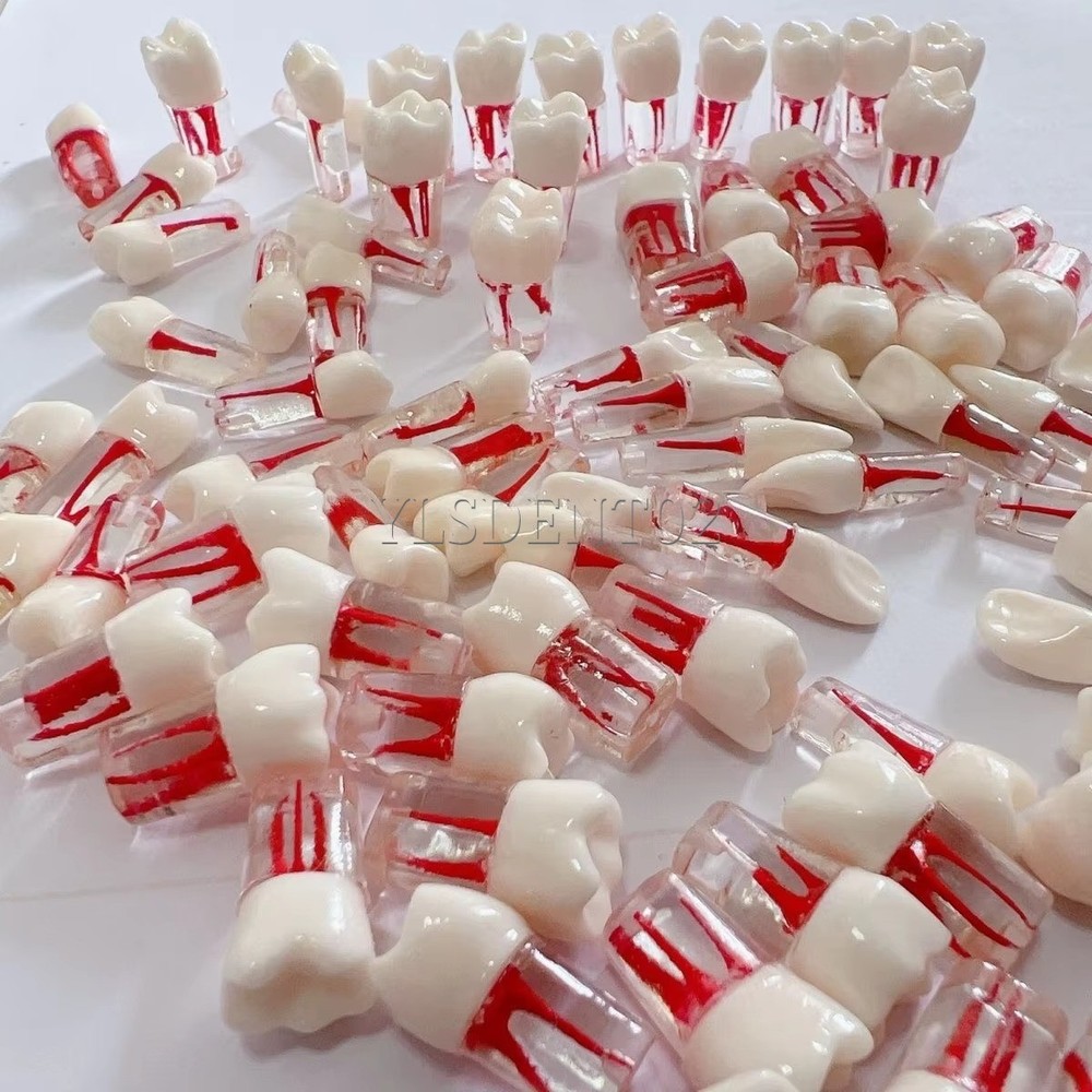 10Pcs Endo Root Canal Practice Teeth Model RCT Pulp Study Educational Kit