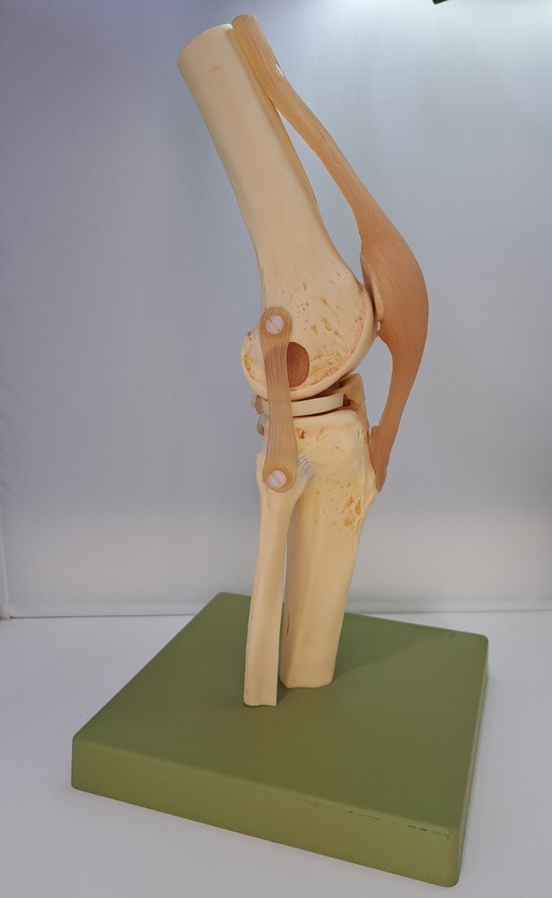 Vintage 1995 Somso Anatomical Model Functional Knee Joint Model BIN86