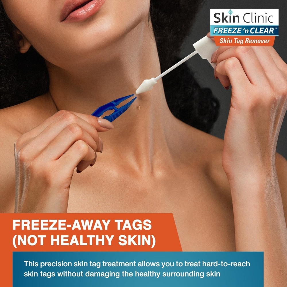 Effortless Skin Tag Treatment Kit - 8 Precision Tips, -Cleared Solution