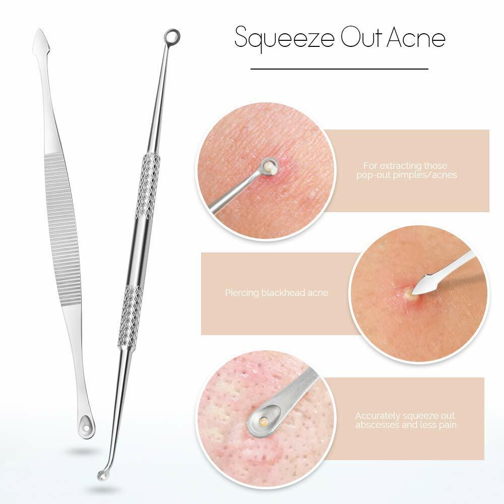 Face Cleansing Acne Beauty Tool Kit Blackhead Extractor 9 Pack