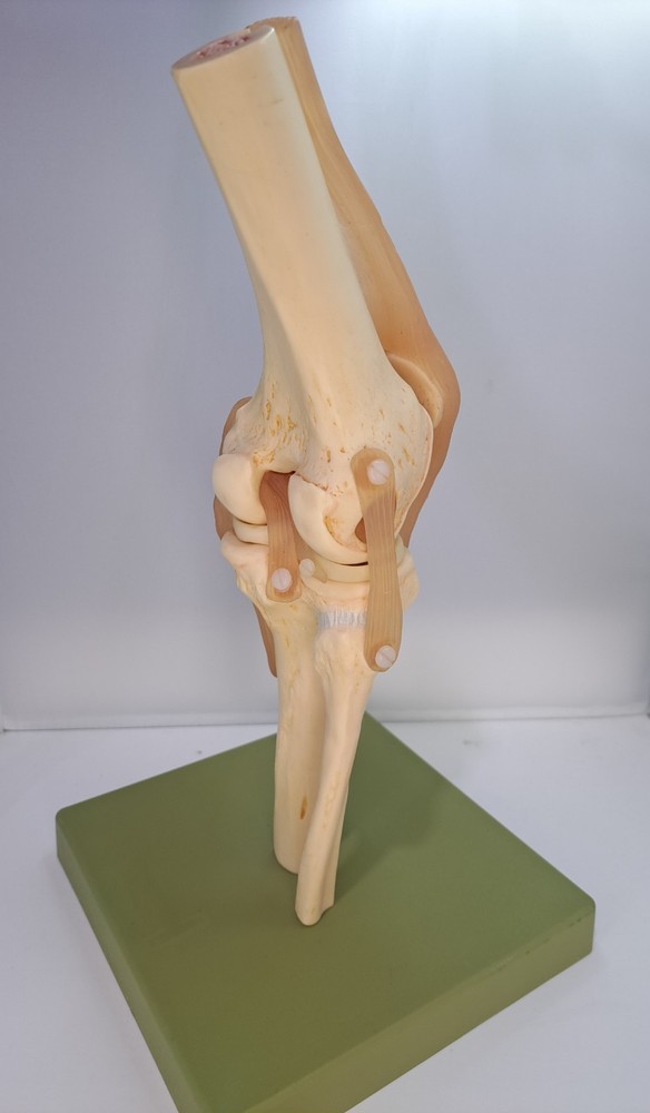 Vintage 1995 Somso Anatomical Model Functional Knee Joint Model BIN86