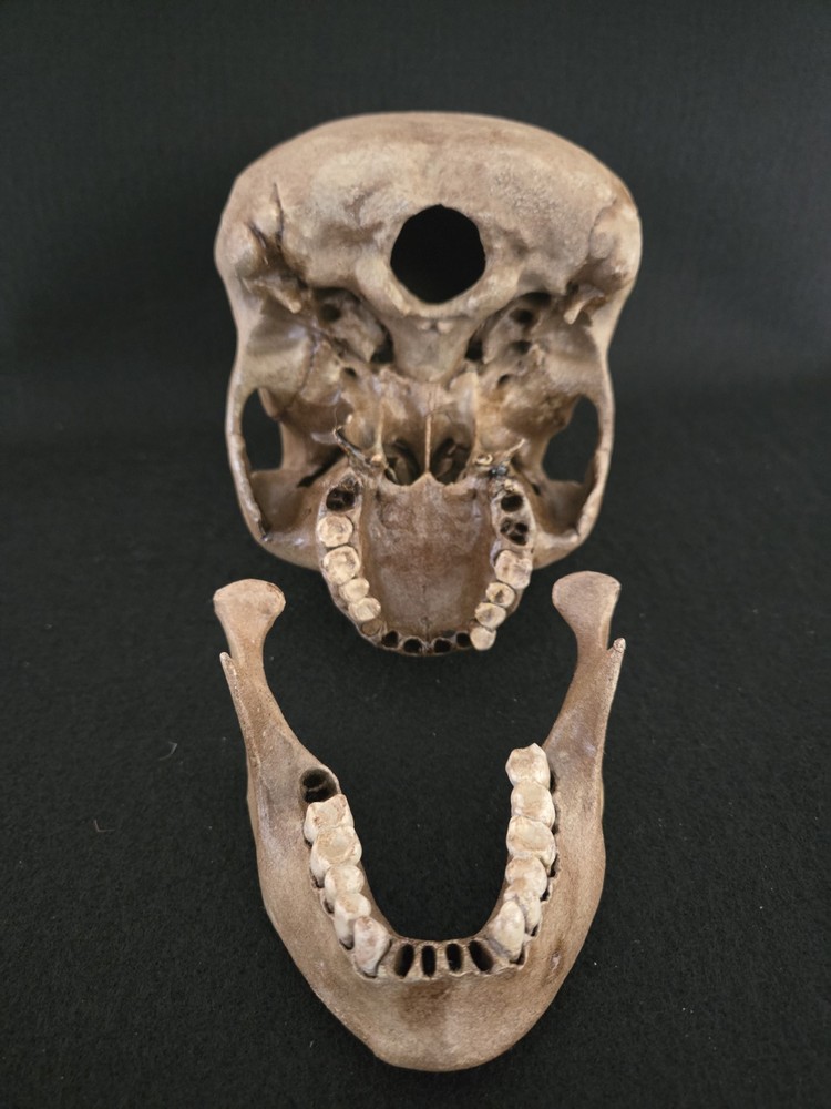 Real Human Skull - Peruvian Enlongated- Hyper Realistic Replica with stand.