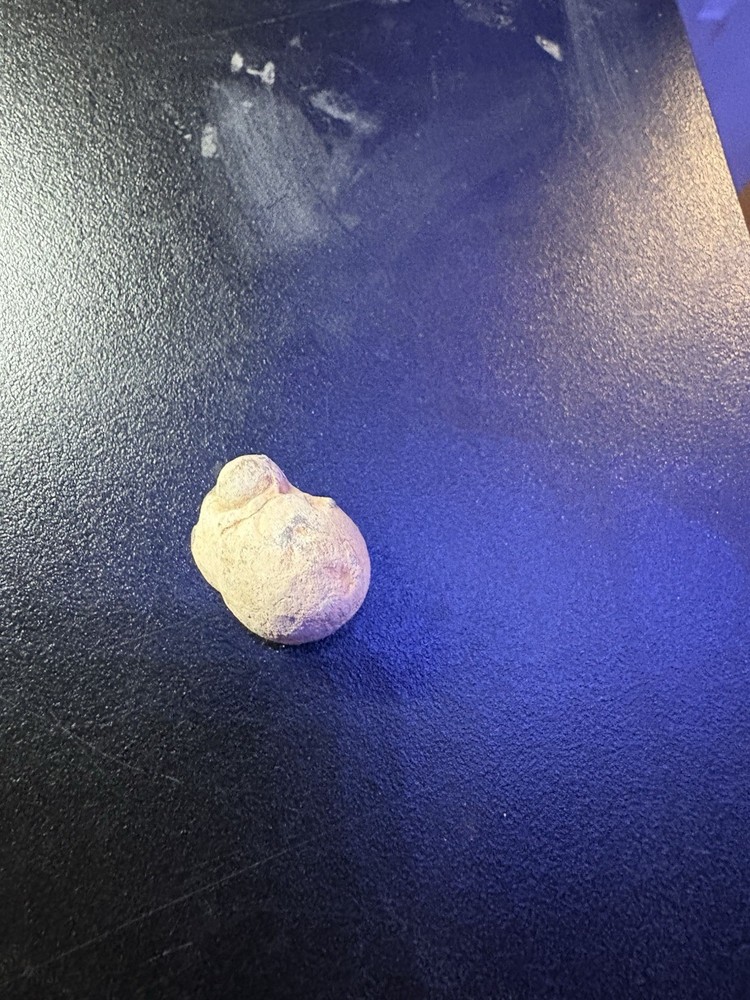 Dug Civil War Relic