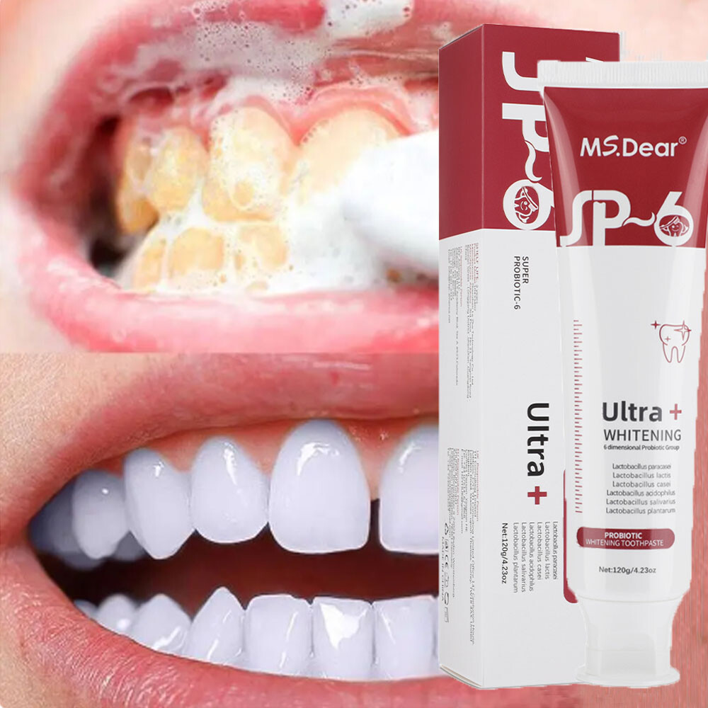 2Pcs Super Probiotic SP-6 Toothpaste, Probiotics Bright White Toothpaste, Sp 6