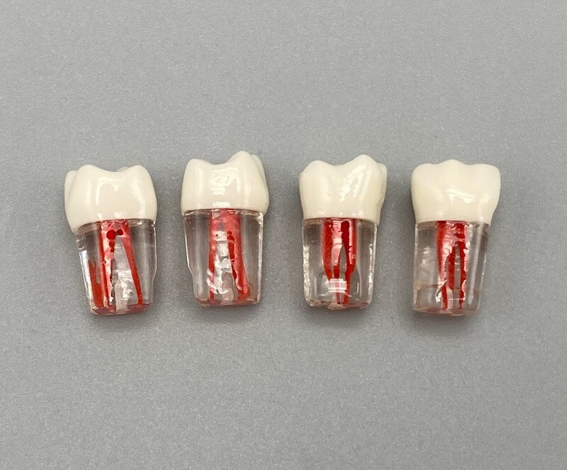 5pcs Dental Root Canal Teeth Study Practice Model Endodontic RCT Endo Pulp File