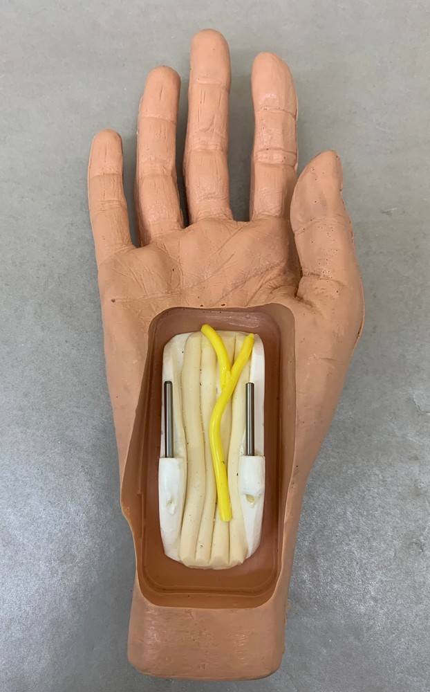 MicroAire 81014 SmartRelease Carpal Tunnel System w/ Hands, Endoscope & More