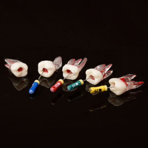 5Pcs Dental Tooth Endo Root Canal Study Model For RCT Practice Block Pulp Cavity