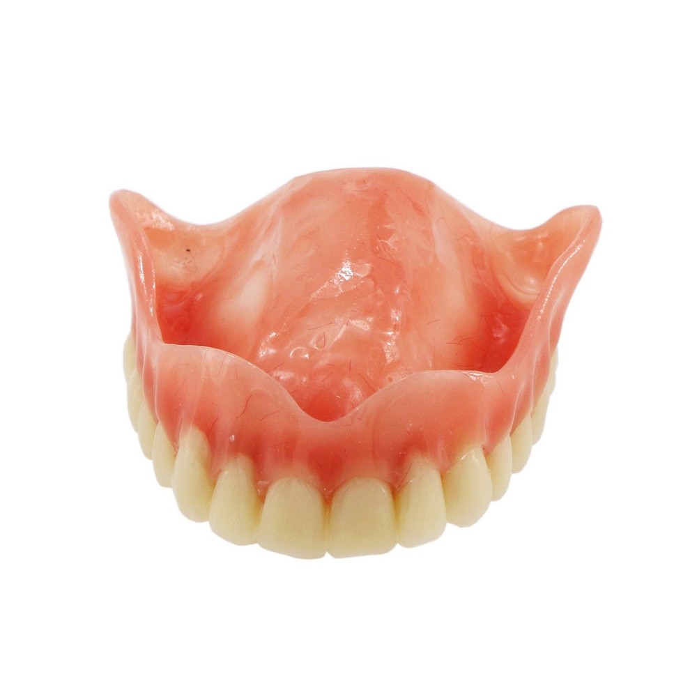 Dental Upper Implants Model Overdenture with 4 Superior Teeth Demo Transparen...