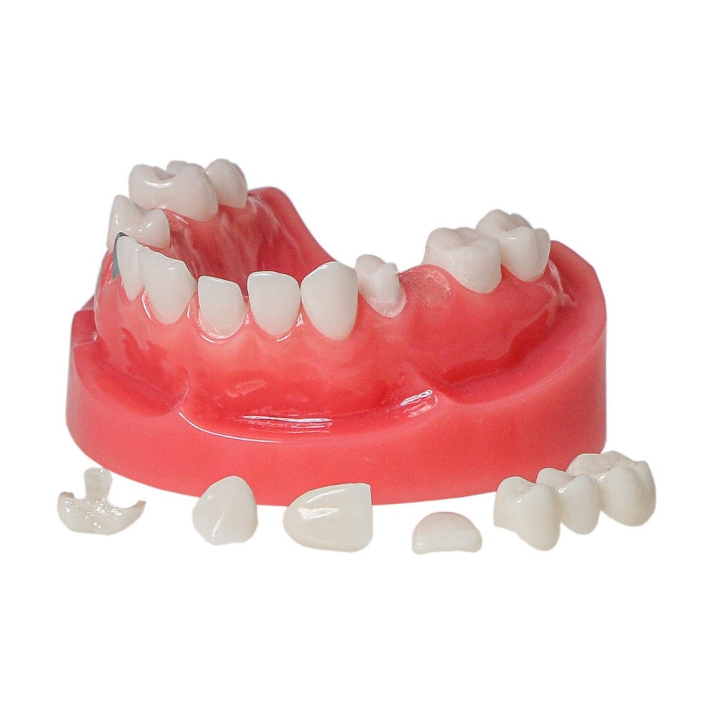 Dental Multi Typodont Teeth Model for Implant Pathological Restoration Practice