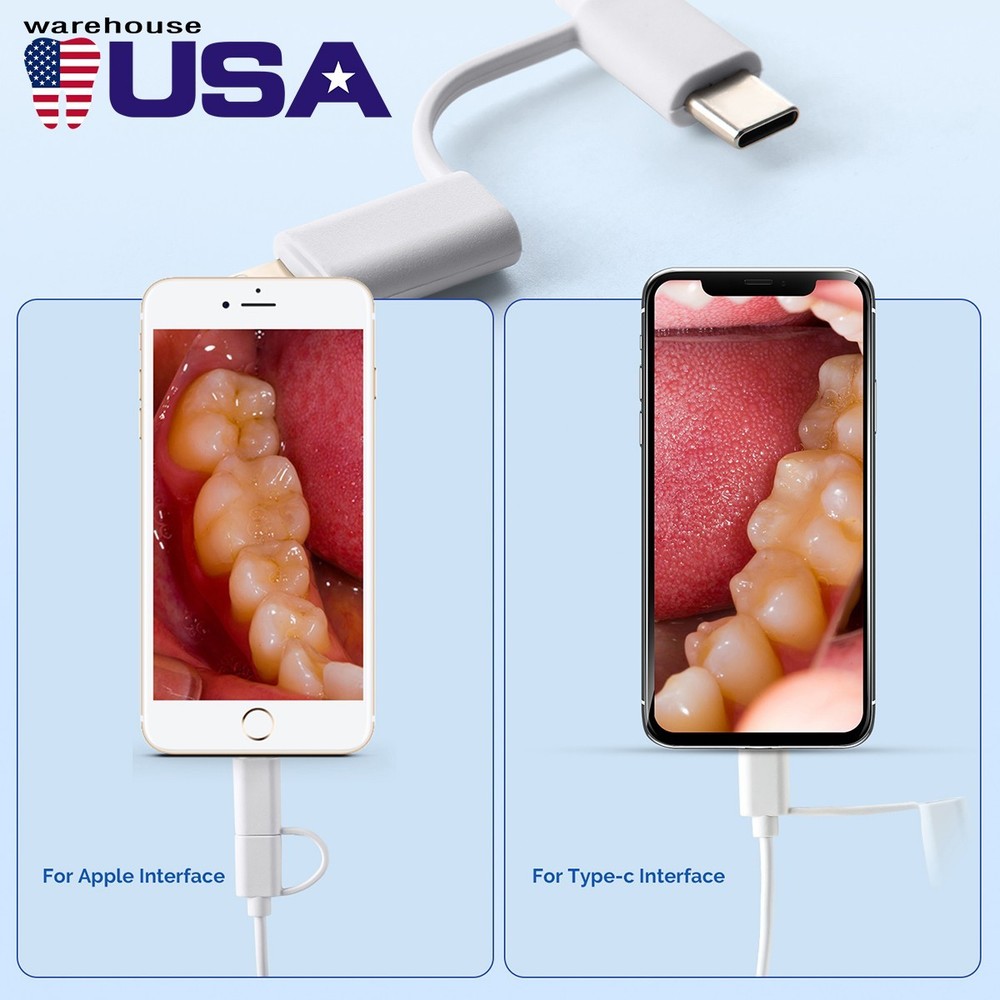 Dental Intraoral Camera LED High Resolution Interface 8 White Cold Light USB