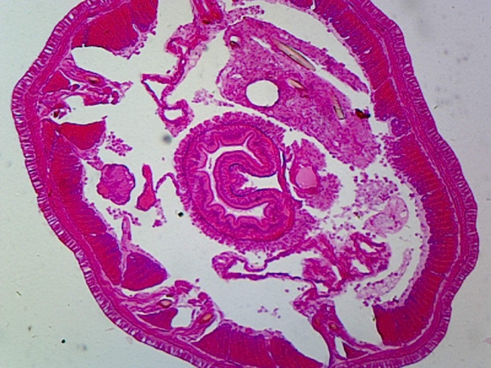 Earthworm (Anellids); Cross Section