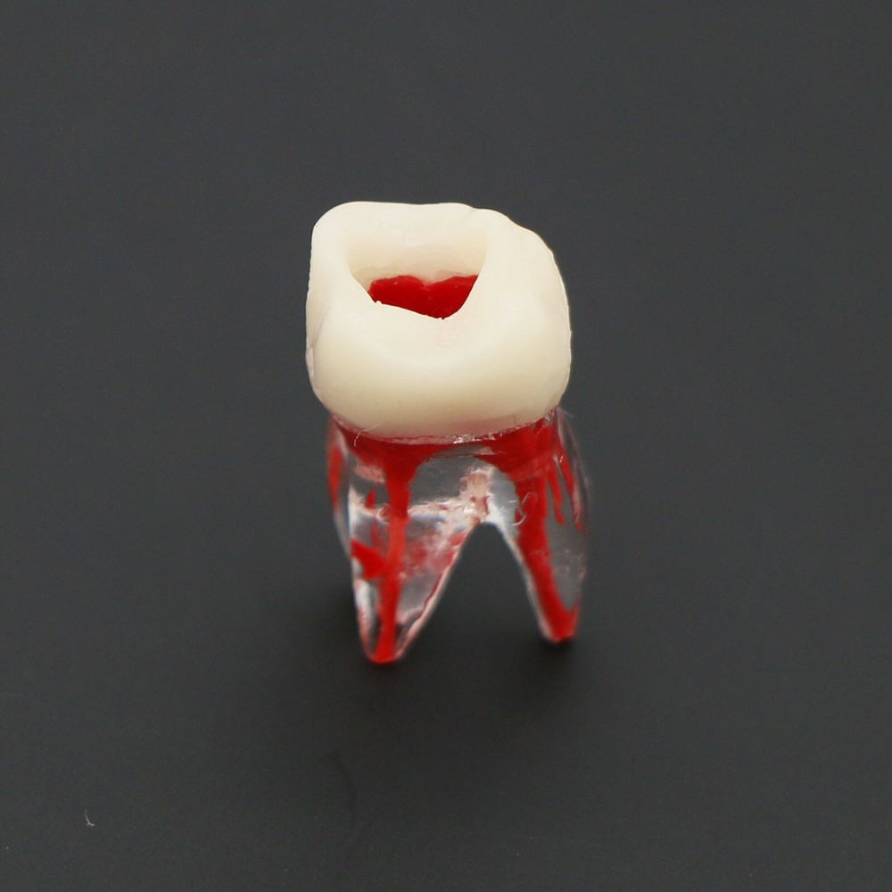 Dental Molar Endo Root Canal Study Model RCT/MTA Practice Block Pulp Cavity